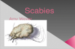  Scabies is a skin disease caused by the mite Sarcoptes scabiei  More than 300 million cases occur worldwide every year  It is also known as the human.