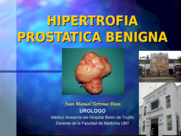 hiperplasia prostatica benigna pdf slideshare prostatita si ozonoterapia